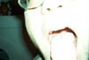 IM000609
